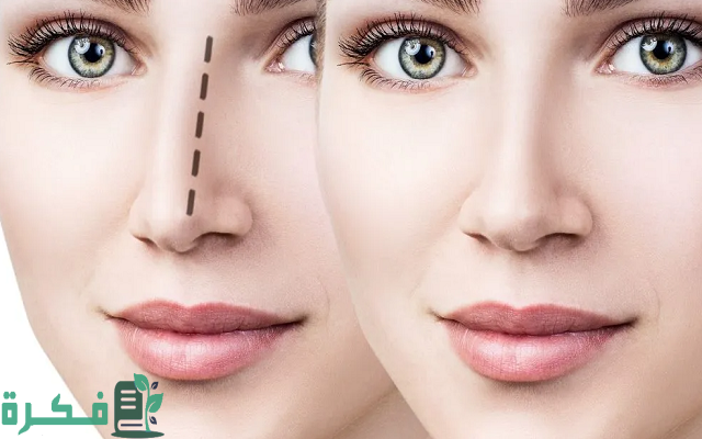 ترتيب الدول العربية في عمليات التجميل