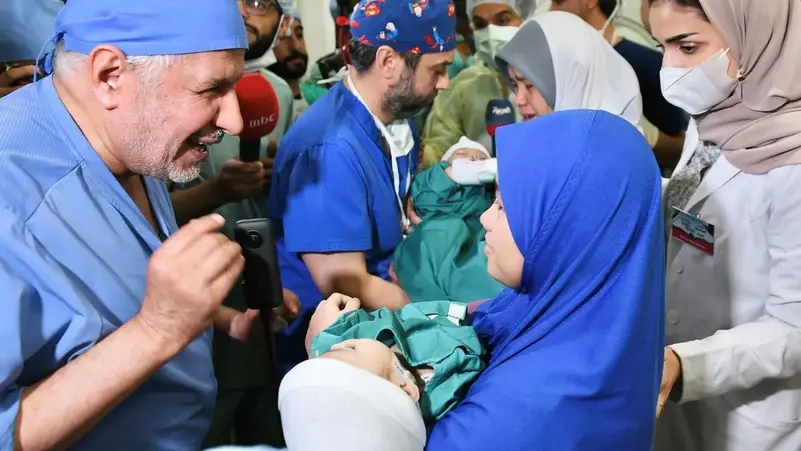 نجاح فصل التوأم السيامي الفلبيني "أكيزا وعائشة"