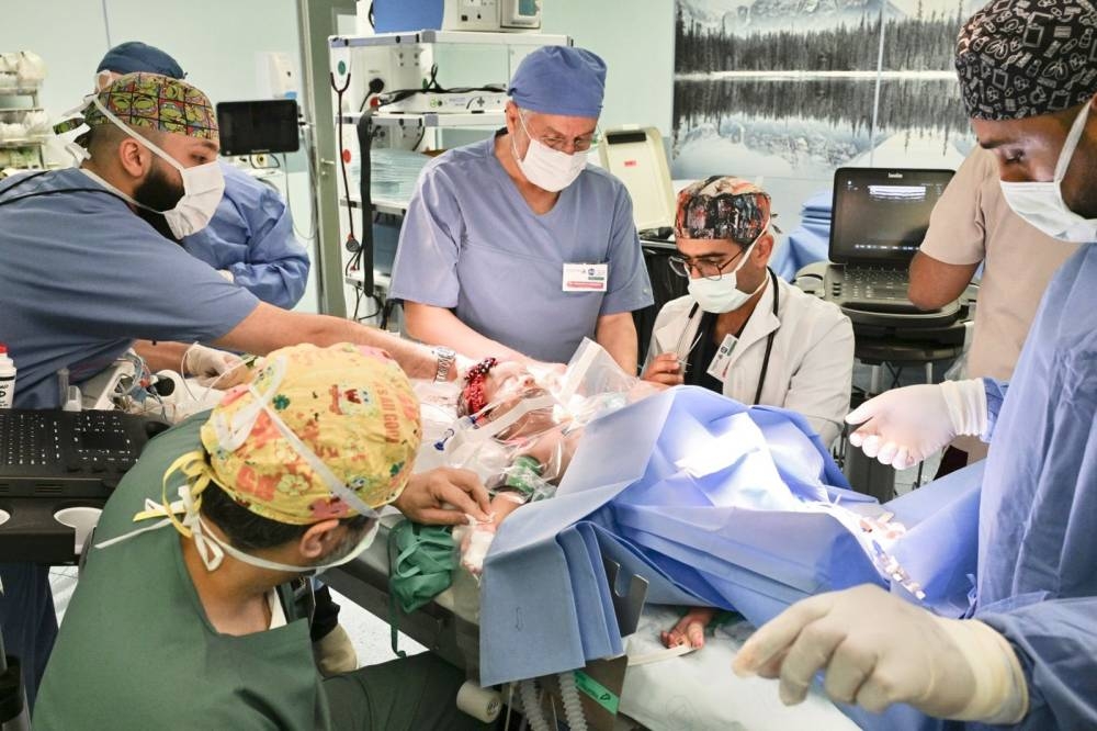 السعودية تتصدر العالم في إجراء عمليات فصل التوائم السيامية 2 السعودية تتصدر العالم في إجراء عمليات فصل التوائم السيامية