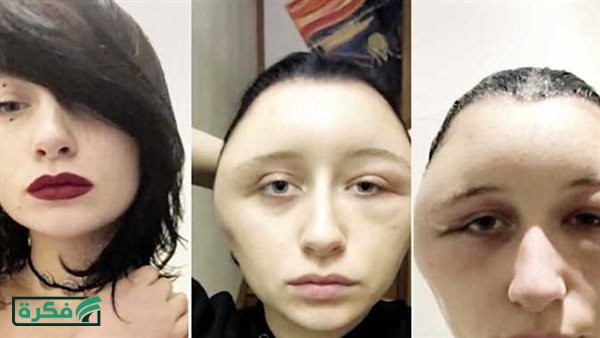 تضاعف حجم رأسها.. فتاة فرنسية تثير الجدل بعد استخدمها صبغة للشعر